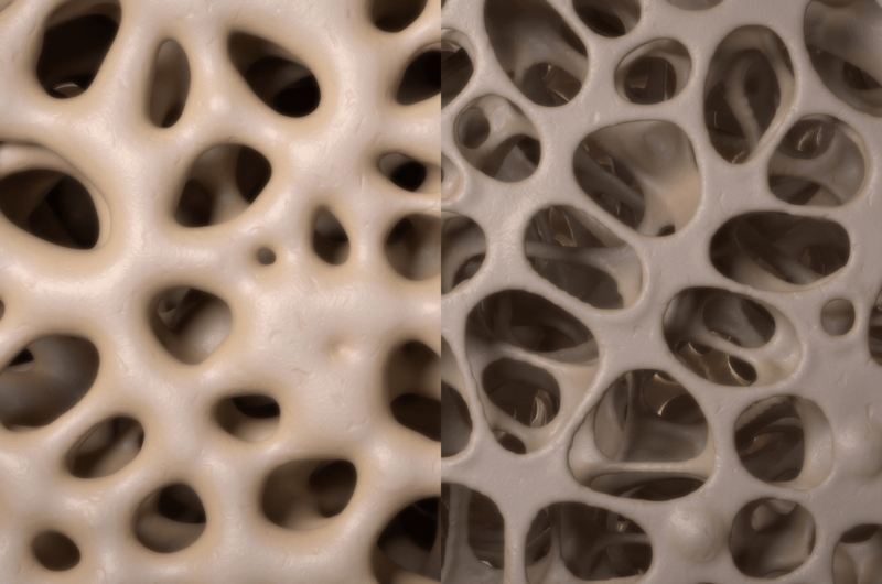 a side-by-side rendering of bones with good and poor density